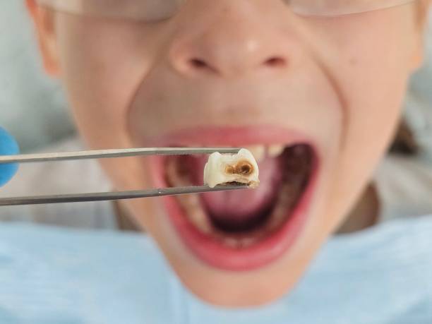Best Emergency Dentist for Knocked-Out Tooth in Bethpage, NY